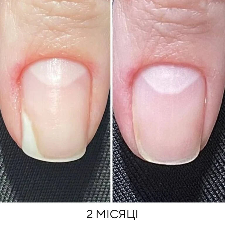 NAILSOFTHEDAY Onistop