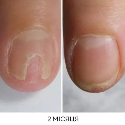 NAILSOFTHEDAY Onistop